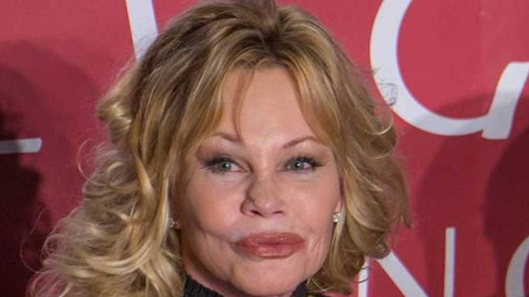 H Melanie Griffith μιλά πρώτη φορά για την περιπέτεια της με τον καρκίνο!