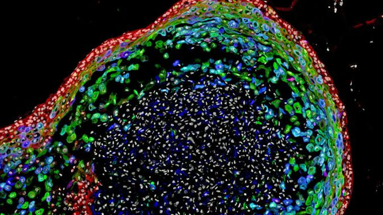 Επιστήμονες δημιούργησαν έναν μίνι ανθρώπινο οισοφάγο