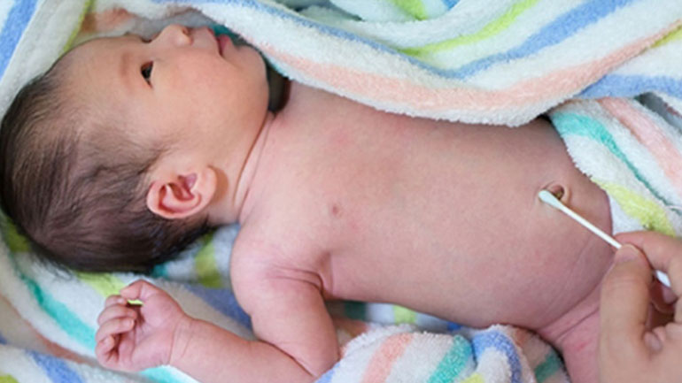 Φροντίδα αφαλού του νεογέννητου