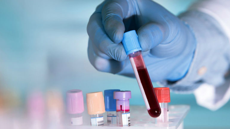 Νέο τεστ αίματος προβλέπει την εξέλιξη της ασθένειας σε όσους νοσούν από Πολλαπλή Σκλήρυνση