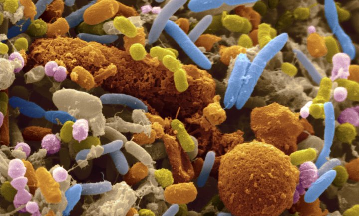 Μας λείπουν τα ευεργετικά βακτήρια του εντέρου λόγω της υπερβολικής χρήσης των αντιβιοτικών;