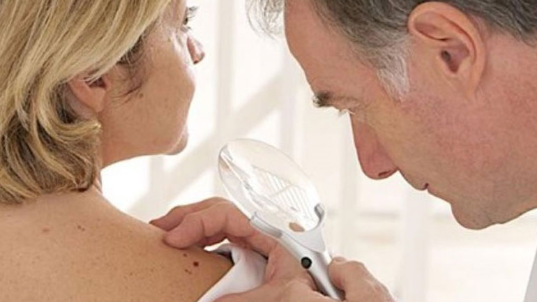 Ο αριθμός των ελιών δείκτης για κίνδυνο καρκίνου