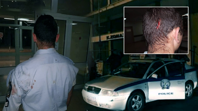 Τραυματισμένοι δύο αστυνομικοί από επίθεση Ρομά