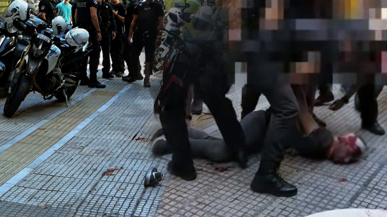 Τα χτυπήματα σκότωσαν τον Ζακ