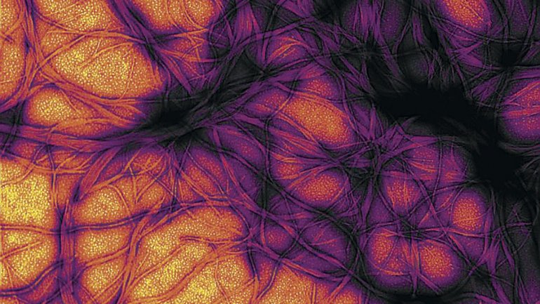 Τα μολυσματικά, θανατηφόρα prions μπορούν να μεταδοθούν μέσω των ματιών των ανθρώπων