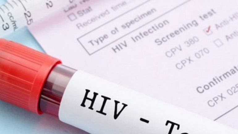 Ποια είναι τα πρώτα συμπτώματα της λοίμωξης από HIV στους άνδρες