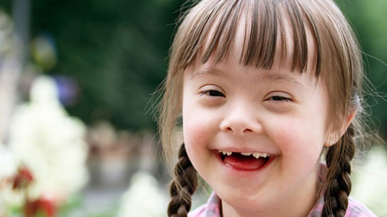 Τι πρέπει να γνωρίζετε για το σύνδρομο Down