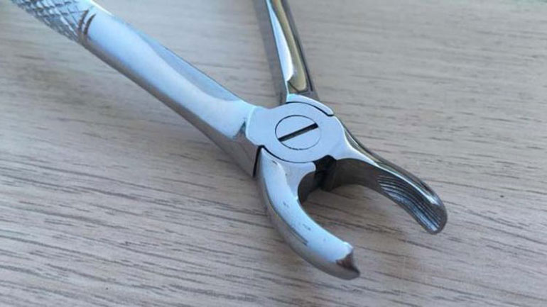 Κύπρος: Ρατσιστές έβγαλαν τα δόντια Αφρικανού με τανάλια