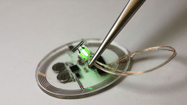 Εμφύτευμα βάζει φρένο στην ακράτεια των ούρων