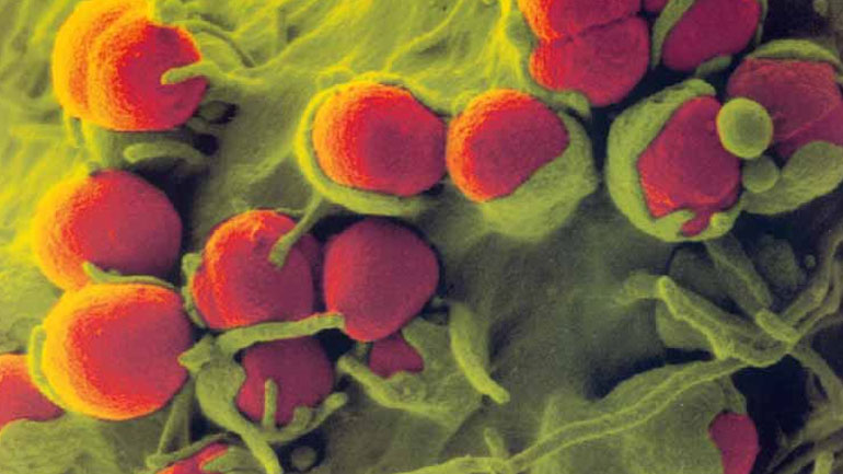 Νέα υποσχόμενη θεραπεία για τη μη επιπλεγμένη γονόρροια