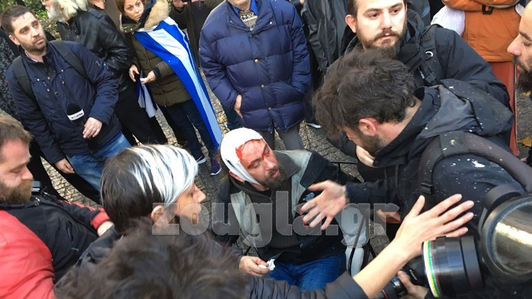 Διοικητικά Συμβούλια των Συνεργαζομένων Ενώσεων στον χώρο του Τύπου: «Οι επιθέσεις δεν φιμώνουν την ενημέρωση»