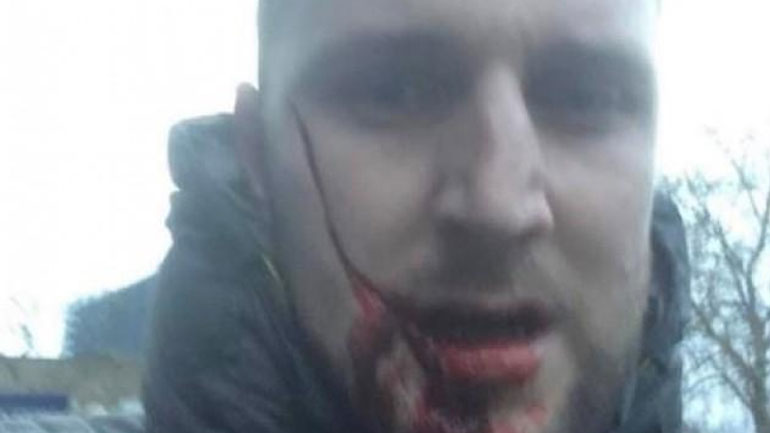 O oπαδός της Έβερτον που μαχαιρώθηκε στο πρόσωπο 