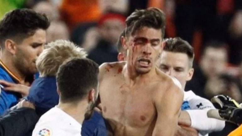 Χαμός στο «Μεστάγια» – Έπαιξαν μπουνιές οι παίκτες στο παιχνίδι Βαλένθια-Χετάφε