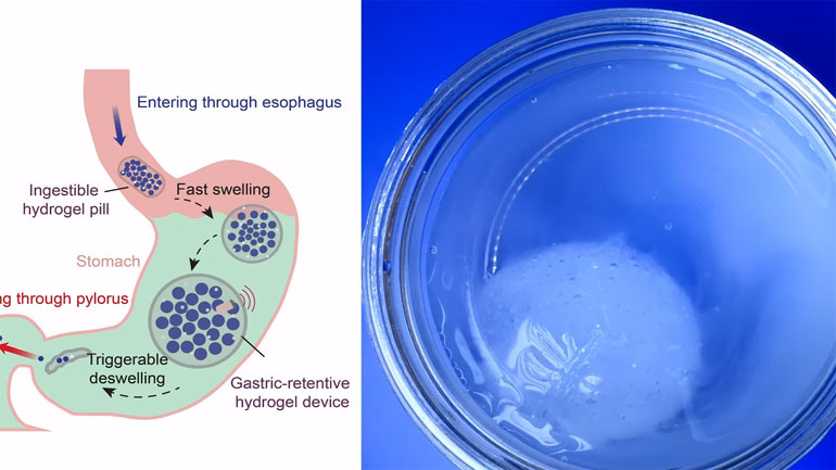 Το πρώτο έξυπνο χάπι «κατάσκοπος» που παρακολουθεί την υγεία του ανθρώπινου οργανισμού