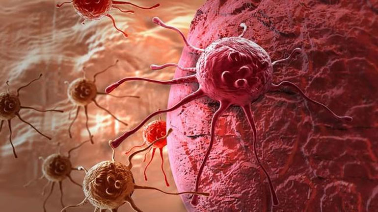 Σταματήστε να «πολεμάτε» τον καρκίνο και αντιμετωπίστε τον όπως τις άλλες ασθένειες