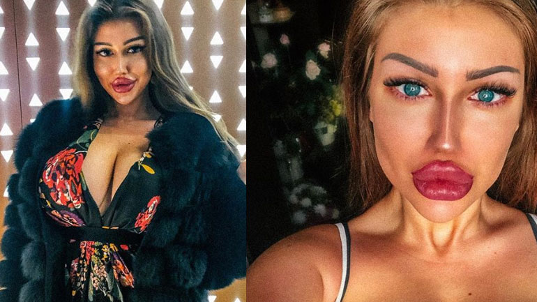 «Τρελαίνει» το Instagram η ρωσίδα «Κιμ Καρντάσιαν»