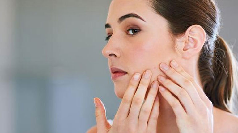 Πώς να αντιμετωπίσεις την ακμή