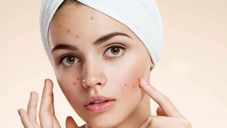 Θαυματουργή μάσκα για την καταπολέμηση της ακμής!