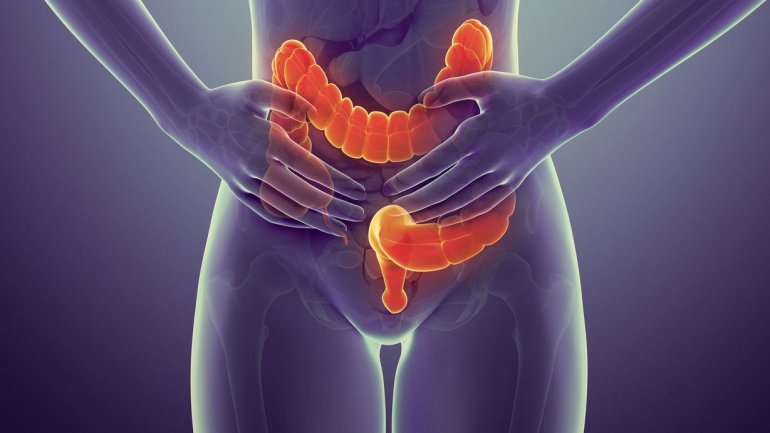 Γιατί τα πολλά λιπαρά αυξάνουν την πιθανότητα για καρκίνο του παχέος εντέρου