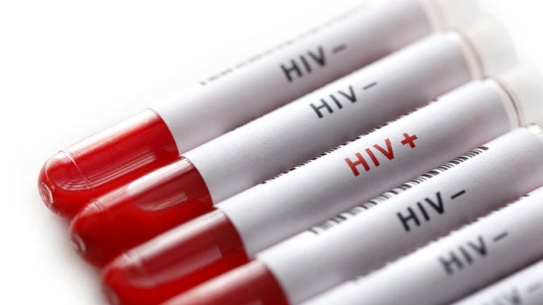 Τι είναι το ιικό φορτίο του HIV;