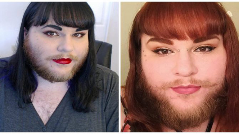 Iνδός χώρισε τη γυναίκα του επειδή όταν της έβγαλε την μαντίλα ανακάλυψε ότι έχει μούσι Iνδός χώρισε τη γυναίκα του επειδή όταν της έβγαλε την μαντίλα ανακάλυψε ότι έχει μούσι