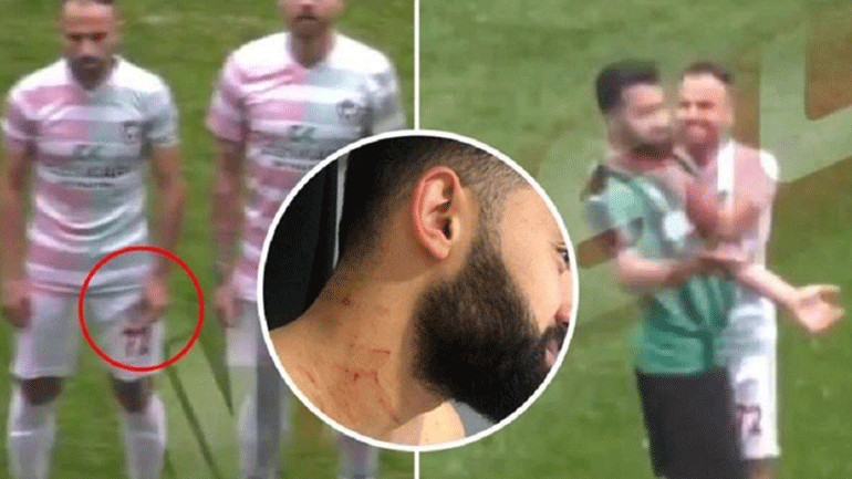 Ισόβιος αποκλεισμός στον Τούρκο ποδοσφαιριστή που επιτέθηκε με ξυράφι εν ώρα αγώνα
