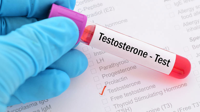 Οι διαταραχές των επιπέδων τεστοστερόνης σε άνδρες και γυναίκες