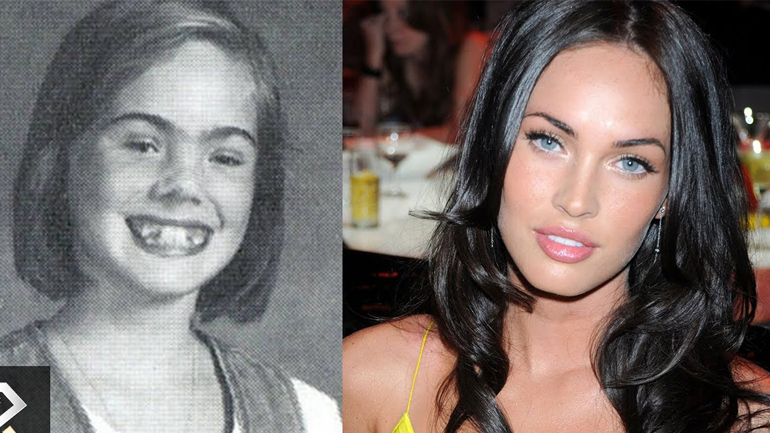 Οι 10 celebrities που ήταν άσχημοι στο σχολείο