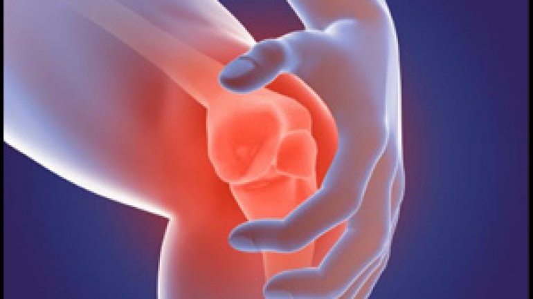 Η άσκηση βοηθά στην πρόληψη της βλάβης του χόνδρου που προκαλείται στην αρθρίτιδα