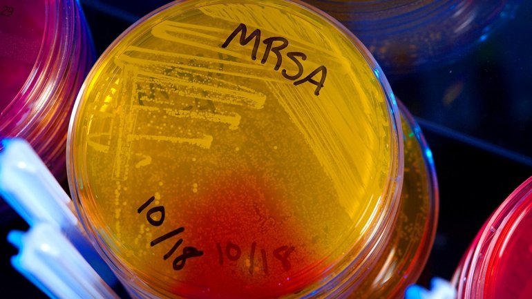 Το μπλε φως θα μπορούσε να καταπολεμήσει τα superbugs