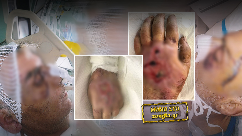 Βάρβαρος ξυλοδαρμός στο Ψυχιατρείο Κορυδαλλού