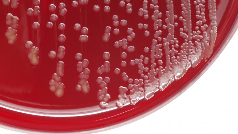 Σε πολλά χέρια νοσοκομειακών ασθενών τα superbugs