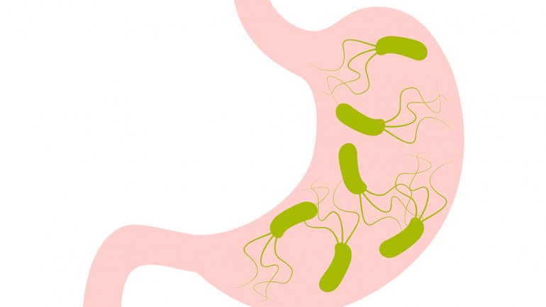 Πώς προκαλεί καρκίνο το ελικοβακτηρίδιο του πυλωρού