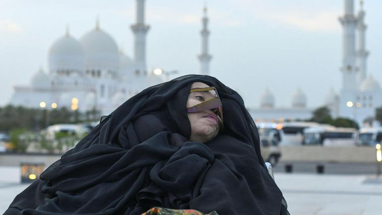 Ιατρικό θαύμα: Γυναίκα ξύπνησε από κώμα έπειτα από 27 χρόνια!