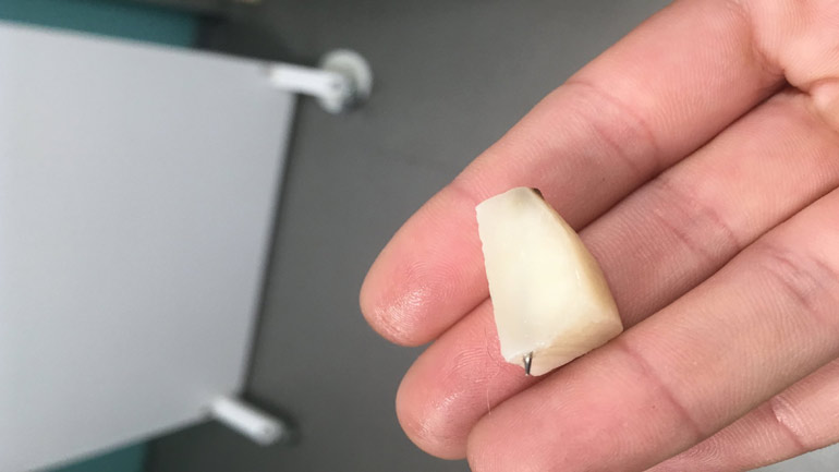 Προσοχή στους ιδιοκτήτες σκύλων: Βρέθηκαν στο πάρκο του ΟΑΚΑ τυριά με καρφιά στο εσωτερικό τους