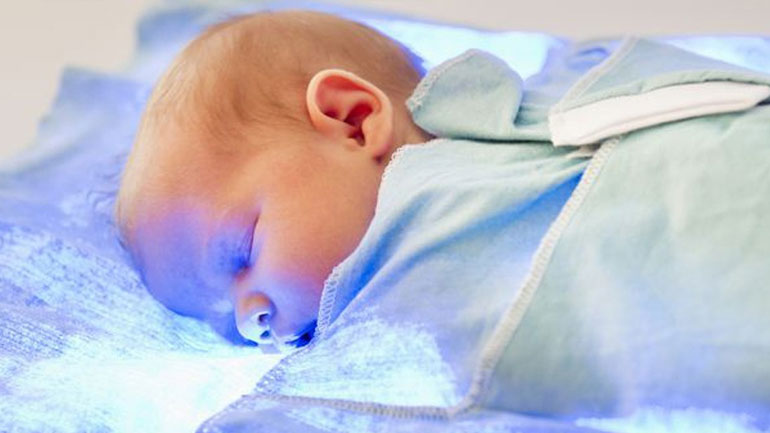 Όλα όσα πρέπει να γνωρίζετε για τον βρεφικό ίκτερο