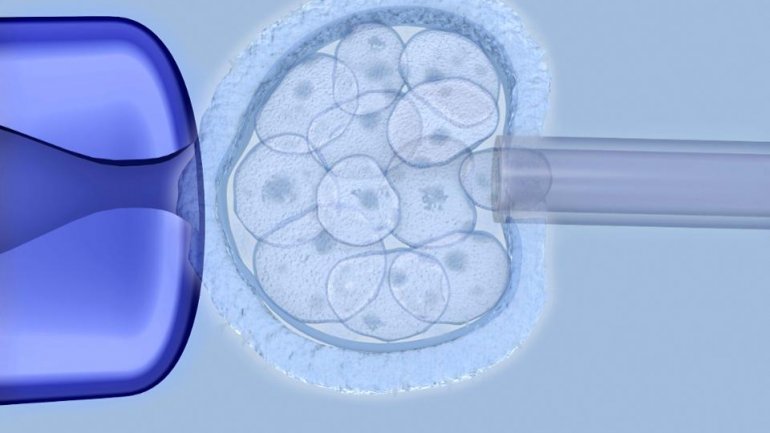 Τι πρέπει να γνωρίζουν τα ζευγάρια που εξετάζουν την εξωσωματική γονιμοποίηση