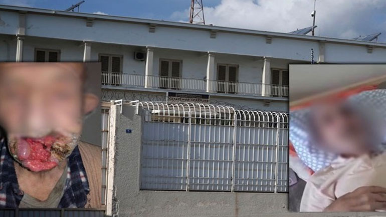 Αποφυλακίζεται ο υπερήλικας καρκινοπαθής μετά από τα δημοσιεύματα του zougla.gr