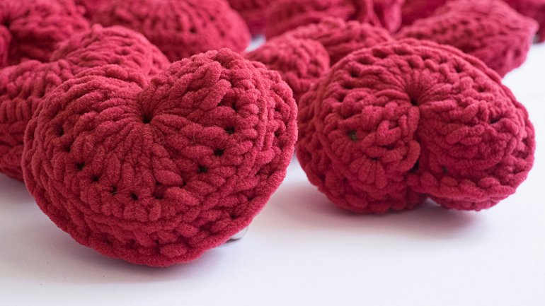 Γενετική θεραπεία θεραπεύει τις βλάβες που προκαλεί η καρδιακή προσβολή