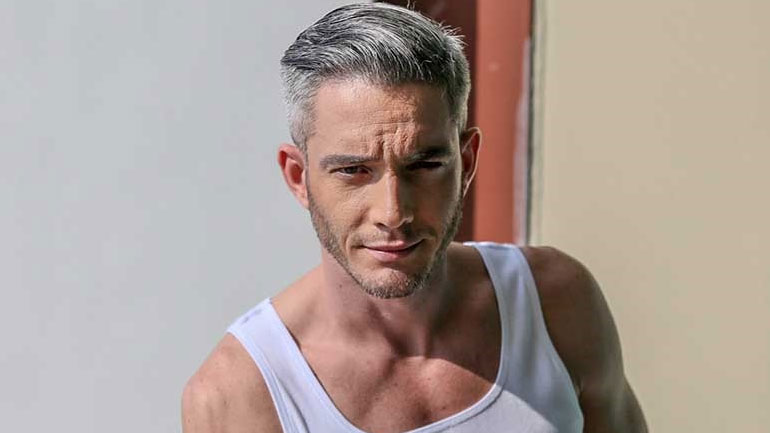 Θεοχάρης Ιωαννίδης: Το αυτοάνοσο νόσημα και ο λόγος που έχασε τα μαλλιά του