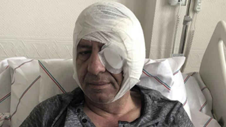 Με βίαιες επιθέσεις συνεχίζεται η καταπίεση  στους Τούρκους δημοσιογράφους