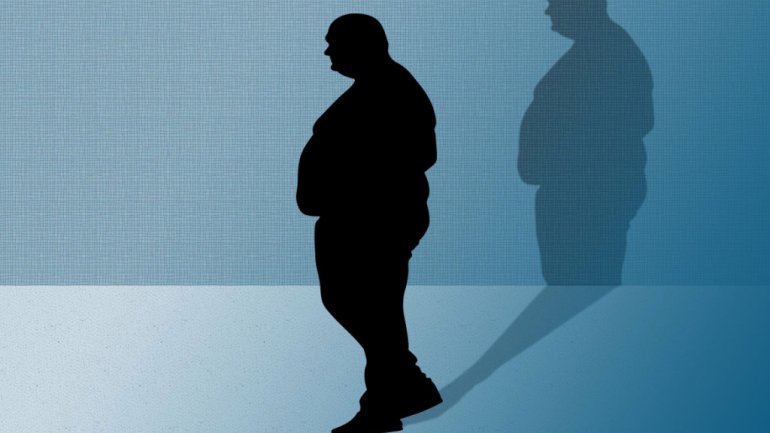Η παχυσαρκία μειώνει το προσδόκιμο ζωής όσο το κάπνισμα