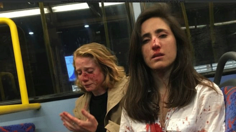 Βαρβαρότητα στην Αγγλία: Γρονθοκόπησαν λεσβίες επειδή… δεν τους έκαναν τα χατίρια