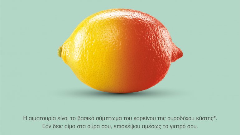 Εκστρατεία ενημέρωσης για τον καρκίνο της ουροδόχου κύστης από τη Roche Hellas