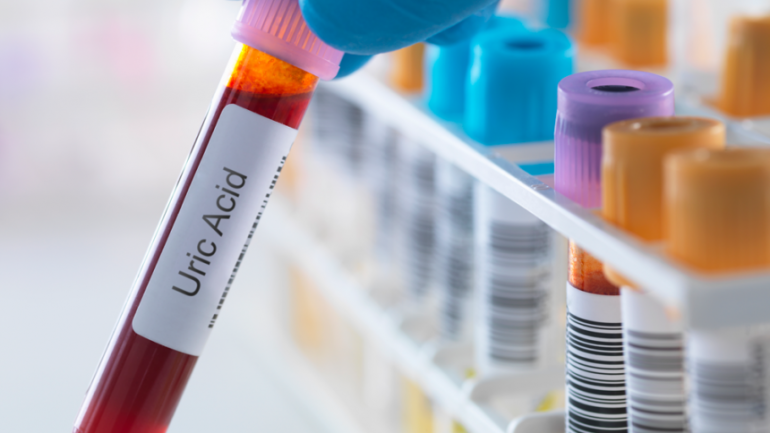 Η έκθεση σε ανόργανη σκόνη αυξάνει τον κίνδυνο ουρικής αρθρίτιδας στις γυναίκες κατά 27%