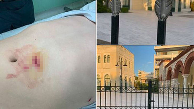 Ανήλικος «καρφώθηκε» στα κάγκελα εκκλησίας στα Βριλήσσια – Τι λέει ο πατέρας του