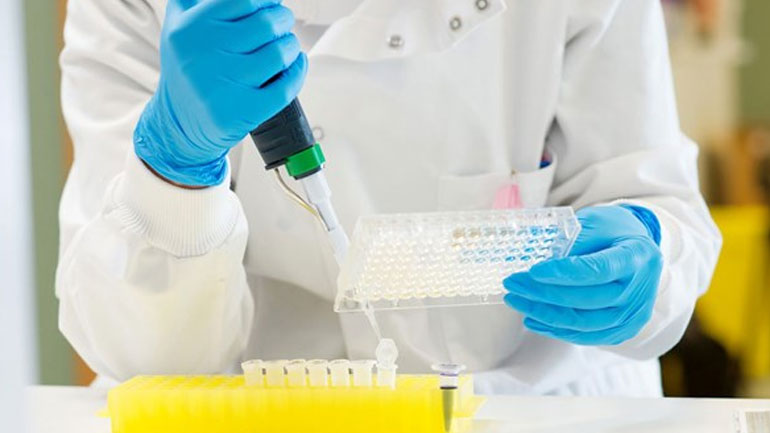 Ένα νέο πειραματικό τεστ ούρων κάνει διάγνωση του επιθετικού καρκίνου του προστάτη