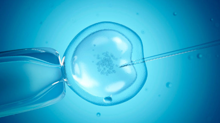 Αυξημένος ο κίνδυνος καρκίνου του μαστού για τις γυναίκες που κάνουν εξωσωματικές μετά τα 40