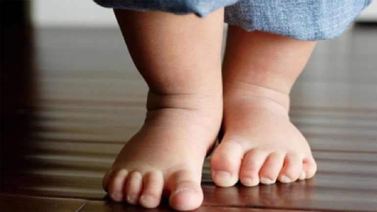 Τι να κάνετε εάν μυρίζουν τα πόδια του παιδιού σας;