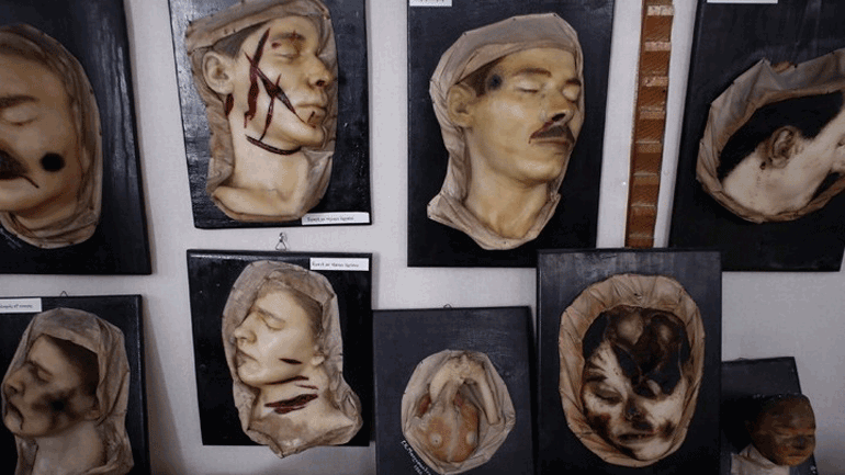 Ένα μουσείο πολύ διαφορετικό από τα άλλα… Περιήγηση στο Εγκληματολογικό Μουσείο της Ιατρικής Σχολής Αθηνών